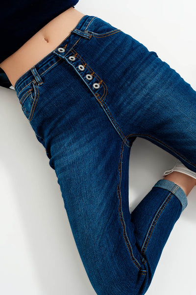 High rise jeans with exposed buttons in blue